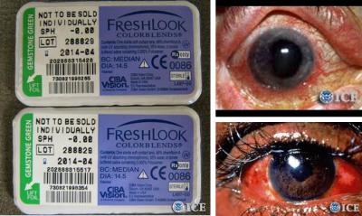 ICE HSI ayuda a investigar lentes de contacto falsificados, mal etiquetados